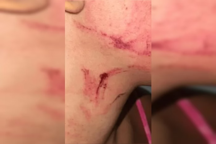 Homem em situação de rua tenta matar mulher para beber o sangue dela