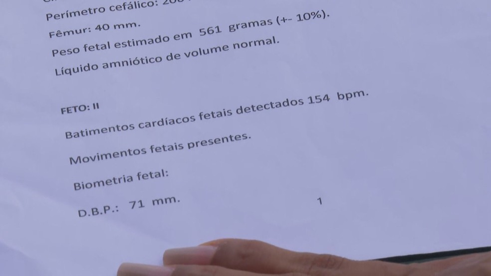 Polícia investiga caso em que mãe diz que foi dar à luz a gêmeas e só recebeu um bebê no Rio — Foto: Reprodução/TV Globo