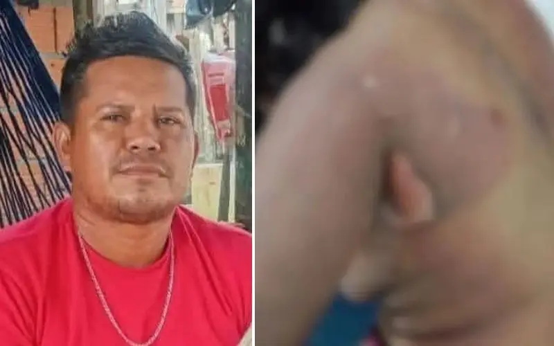 Homem que ateou fogo na ex-companheira é procurado no AM