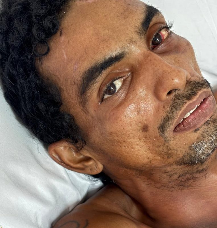 Hospital procura familiares de paciente internado após sofrer choque elétrico em Manaus