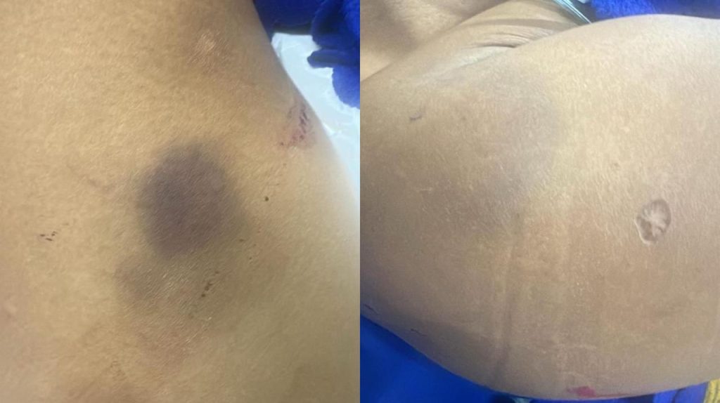 VÍDEO: Homem é preso por espancar e esfaquear mulher por ciúmes em Manacapuru