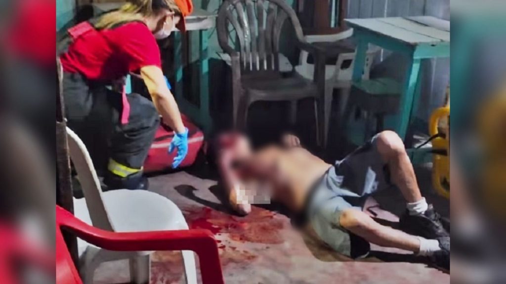 IMAGEM FORTE: Dono de bar é espancado durante assalto em Itacoatiara