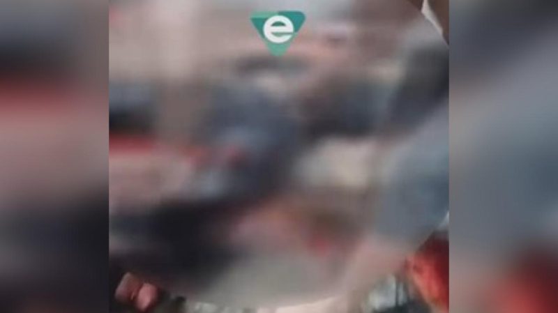 Acidente entre carro e moto na contramão deixa motociclista com a perna esmagada em Manaus