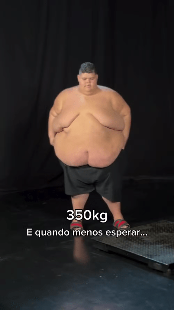 Gordão da XJ exibe antes e depois após sair de 350 kg para 220 kg; veja antes e depois