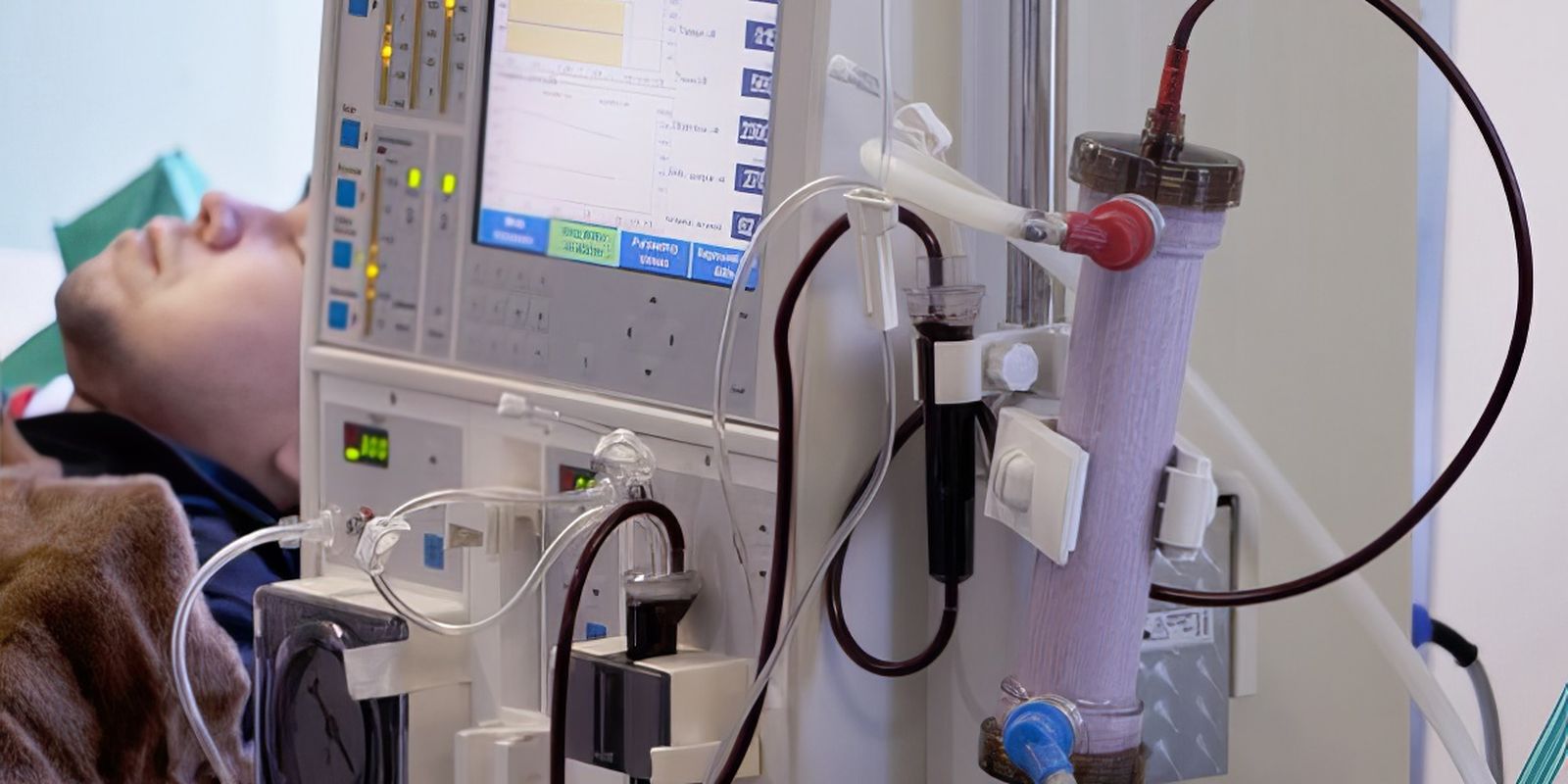 Estudo alerta para subdiagnóstico da doença renal crônica no Brasil