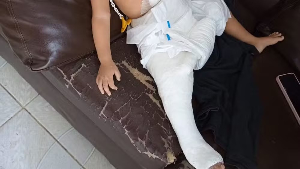 VÍDEOS: Mãe é denunciada após filha de 1 ano sofrer fratura na perna em Manaus