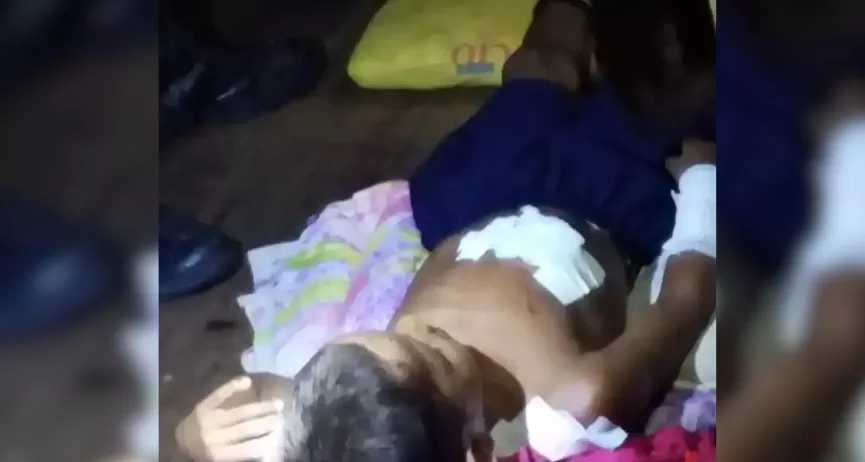 Criança é mordida por jacaré em comunidade rural no Amazonas